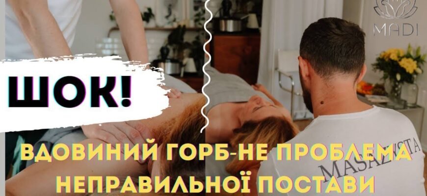 Бруксизм: що це таке, причини виникнення та як з ним боротися