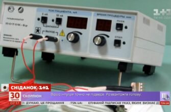 Електрофорез: що це таке та як він працює? Все про методику