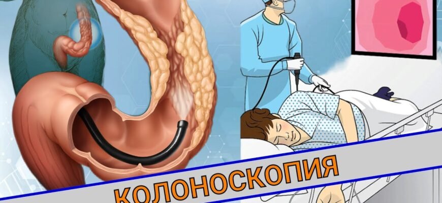 Панендоскопія до дванадцятипалої кишки: все, що потрібно знати