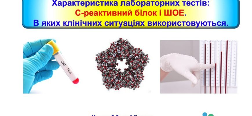 Що таке С-реактивний білок: значення, аналізи та вплив на здоров’я