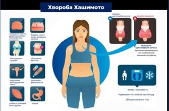 Що таке тиреоїдит: причини, симптоми та методи лікування захворювання