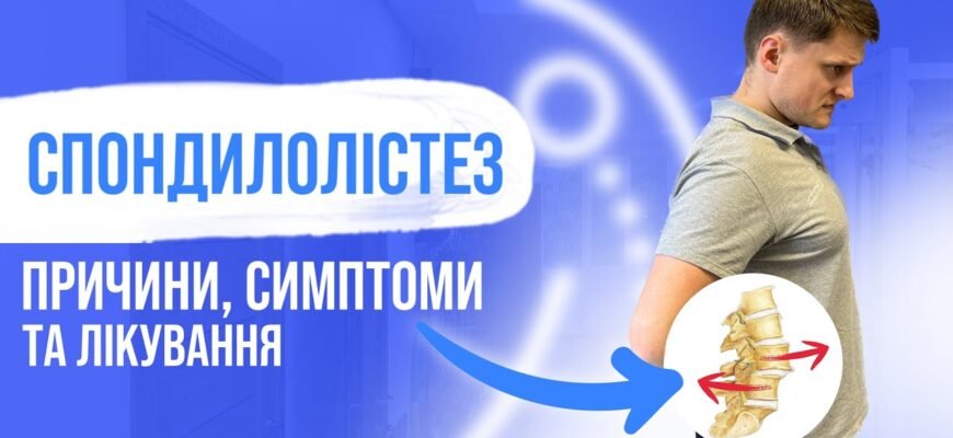 Спондилолістез: що це таке, причини, симптоми та лікування